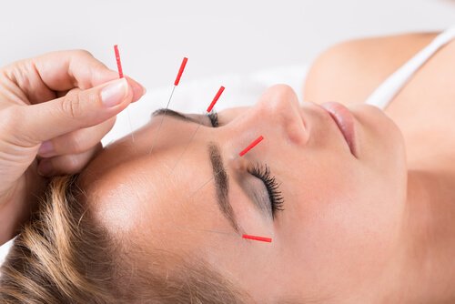 Acupuncture Sudbury MA for Stress Management